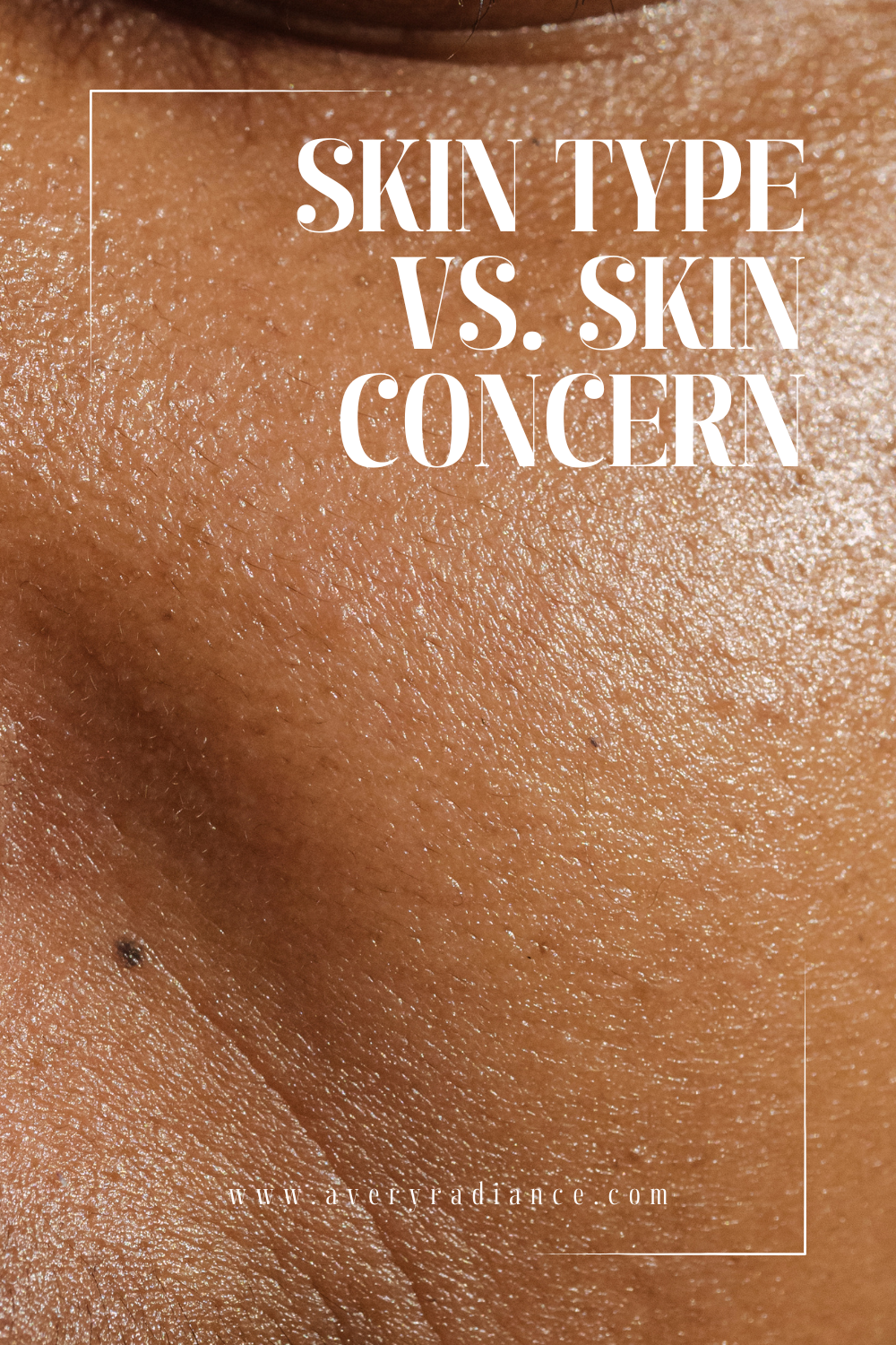 Skin Type vs Skin Concern: Understanding the Difference for Clearer Skin