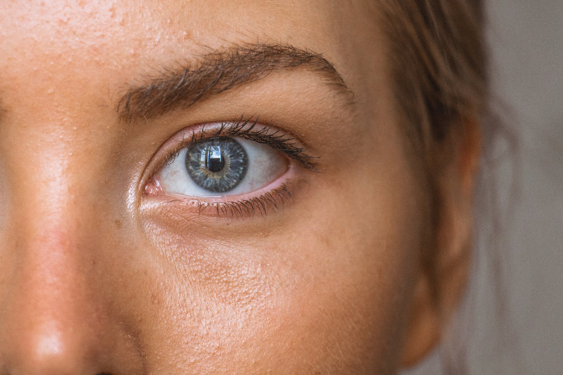 Embrace Radiance: Banishing Dark Circles the Natural Way!