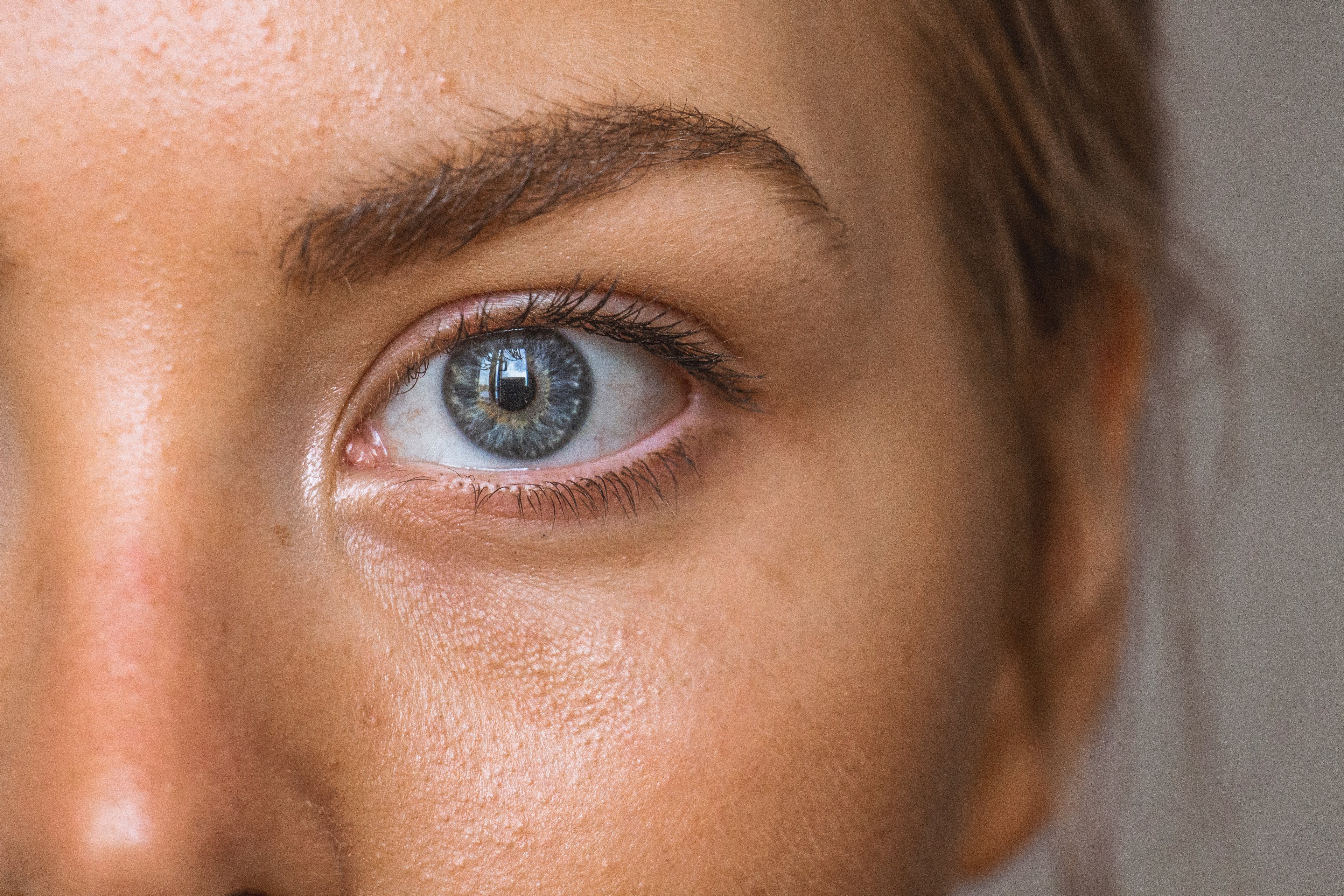Embrace Radiance: Banishing Dark Circles the Natural Way!